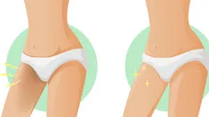 Resultado do procedimento