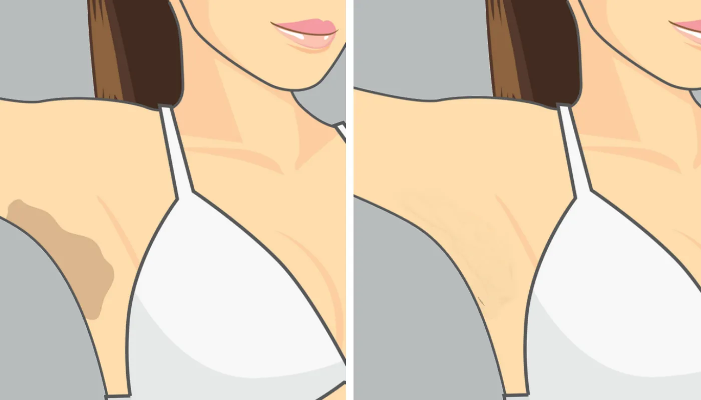 Resultado do procedimento